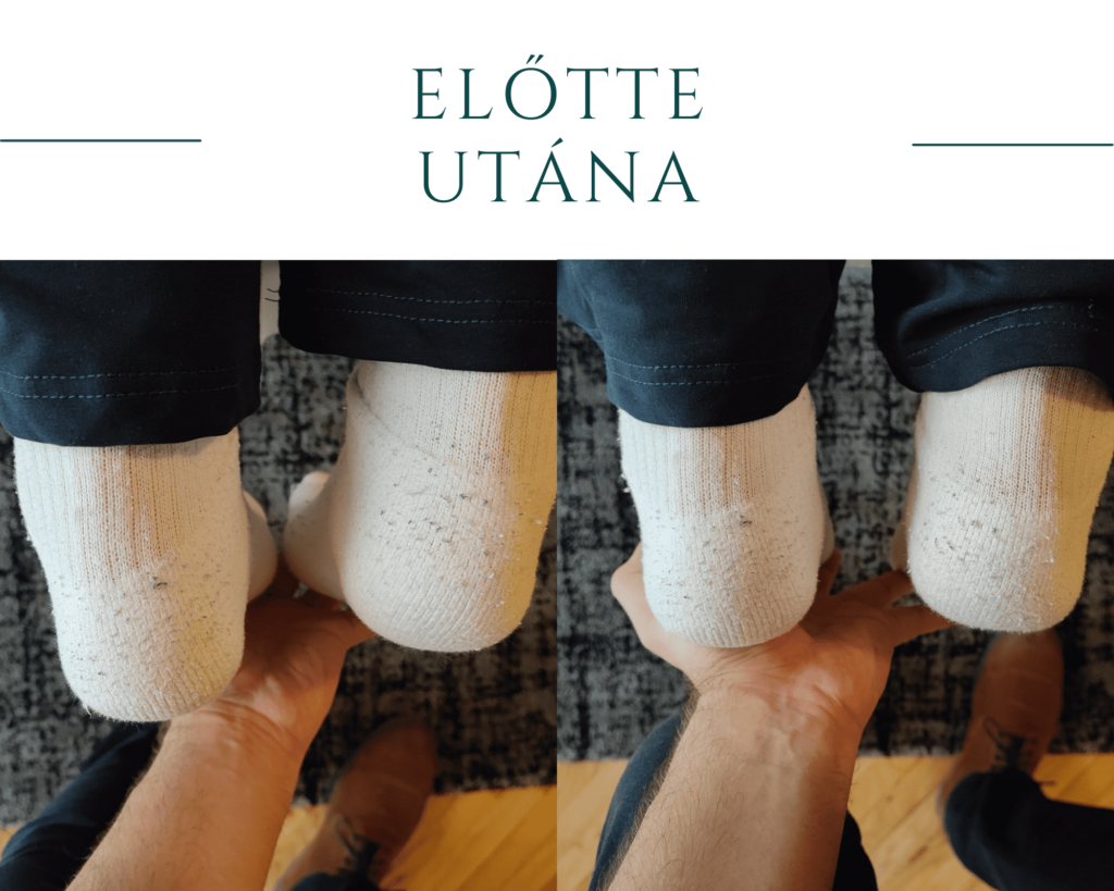 elŐtte-utÁna_optimized (1)